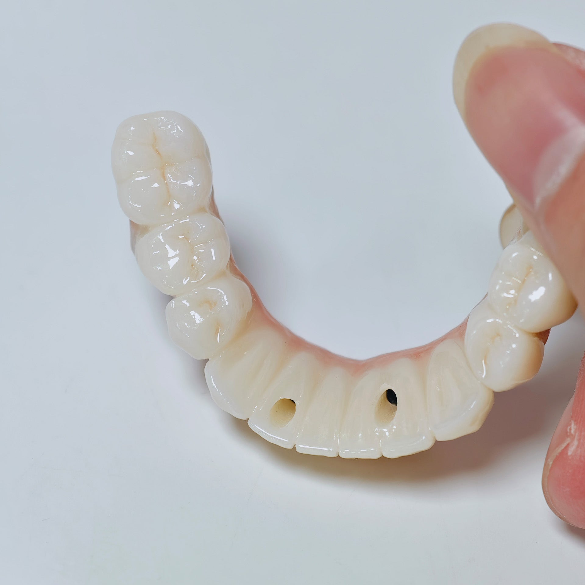 All On 4 Zirconia Bridge With Ti-Base Screw Retained