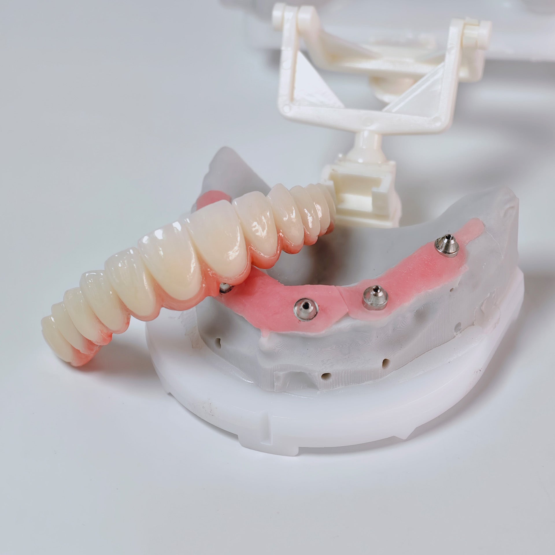All On 6 Zirconia Bridge With Ti-Base Screw Retained