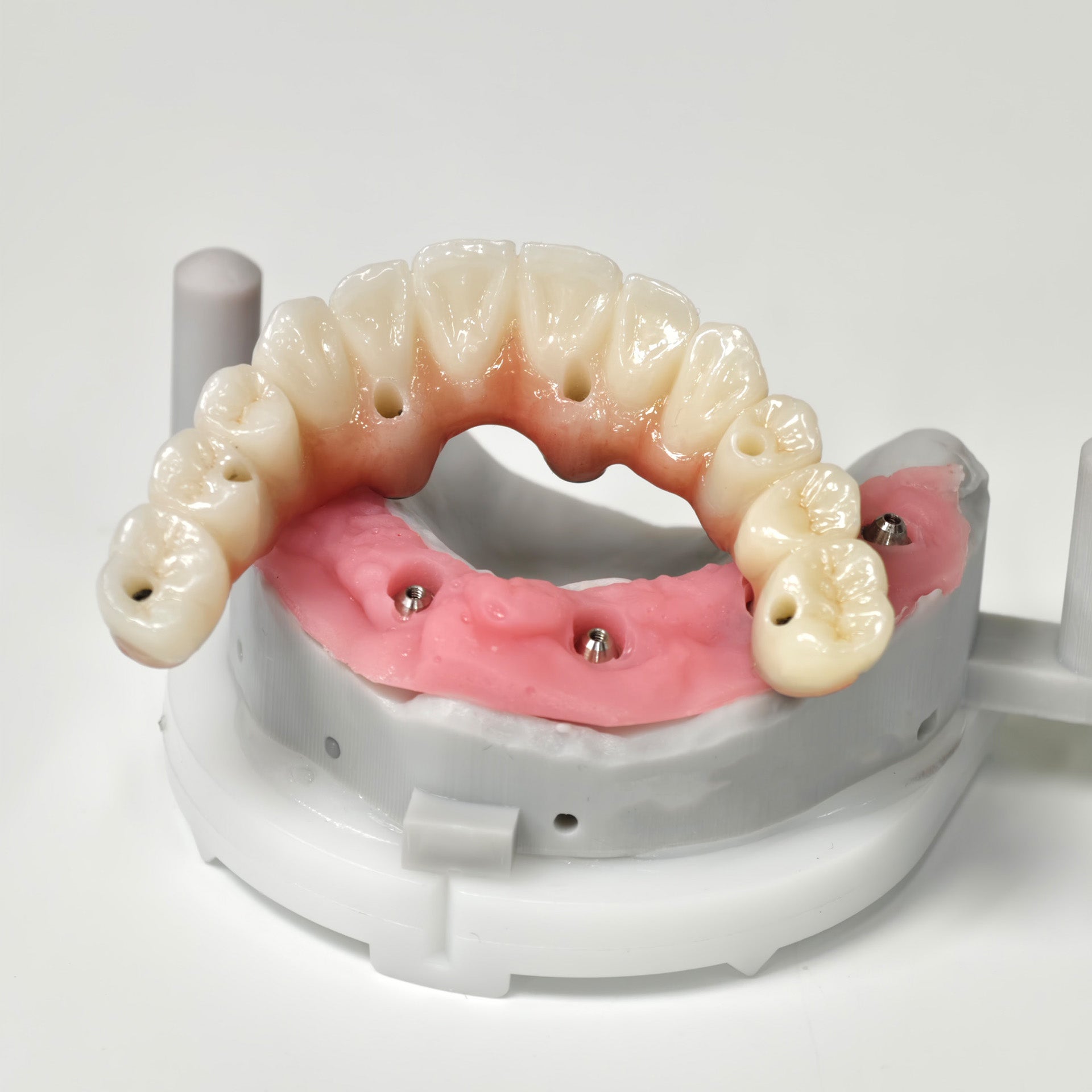 All On 6 Zirconia Bridge With Ti-Base Screw Retained