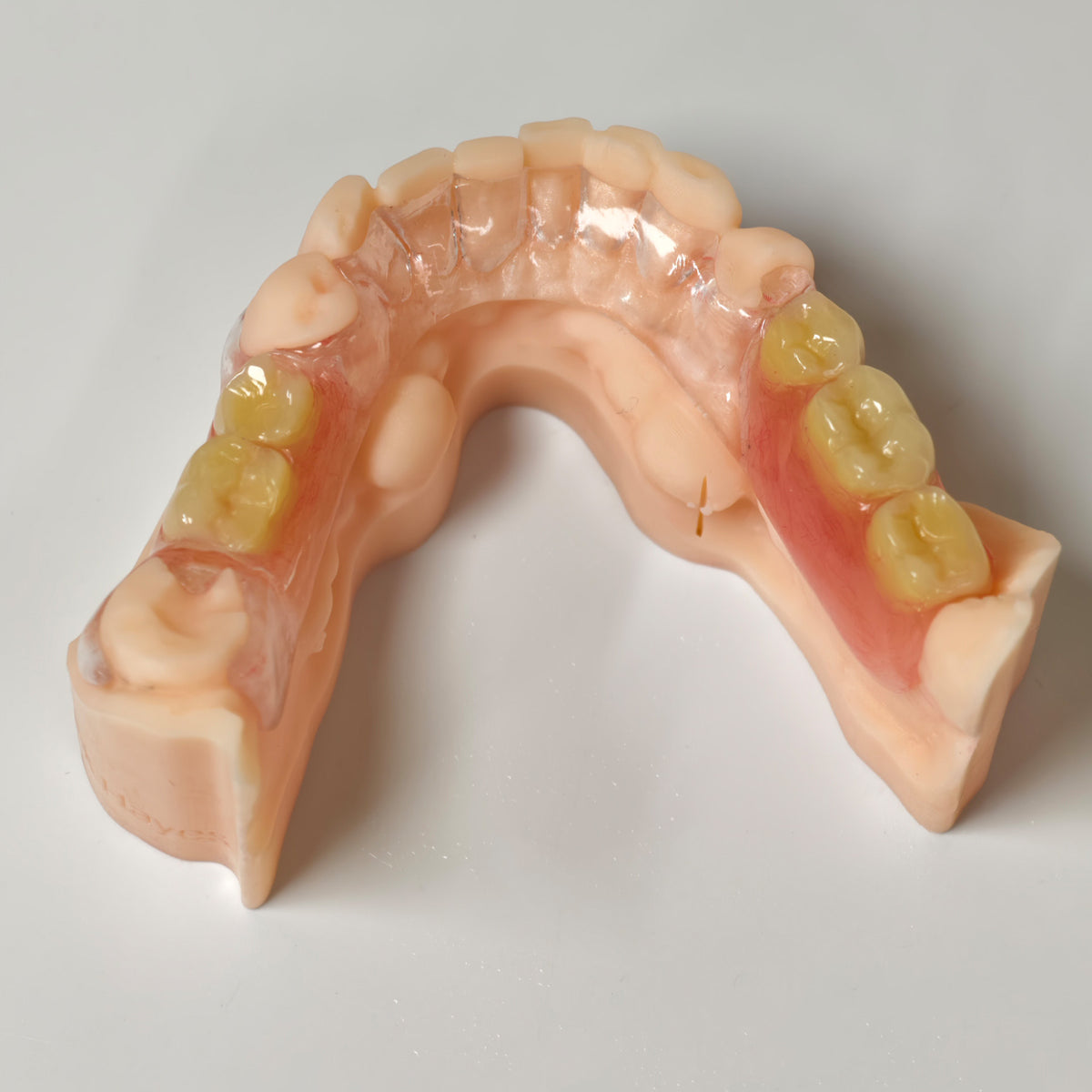 Clear Framework With Acrylic Denture Aesthetic Denture