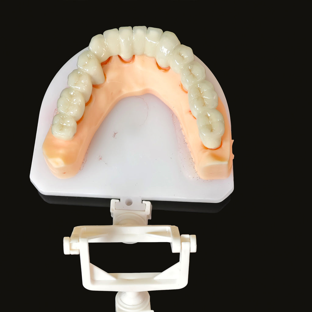 Co - Cr PFM Dental Bridge