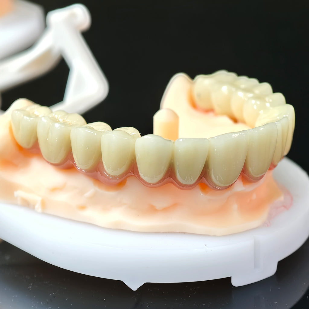 Co - Cr PFM Dental Bridge