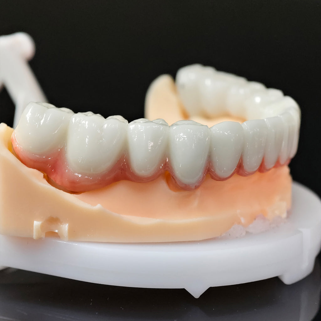 Co - Cr PFM Dental Bridge