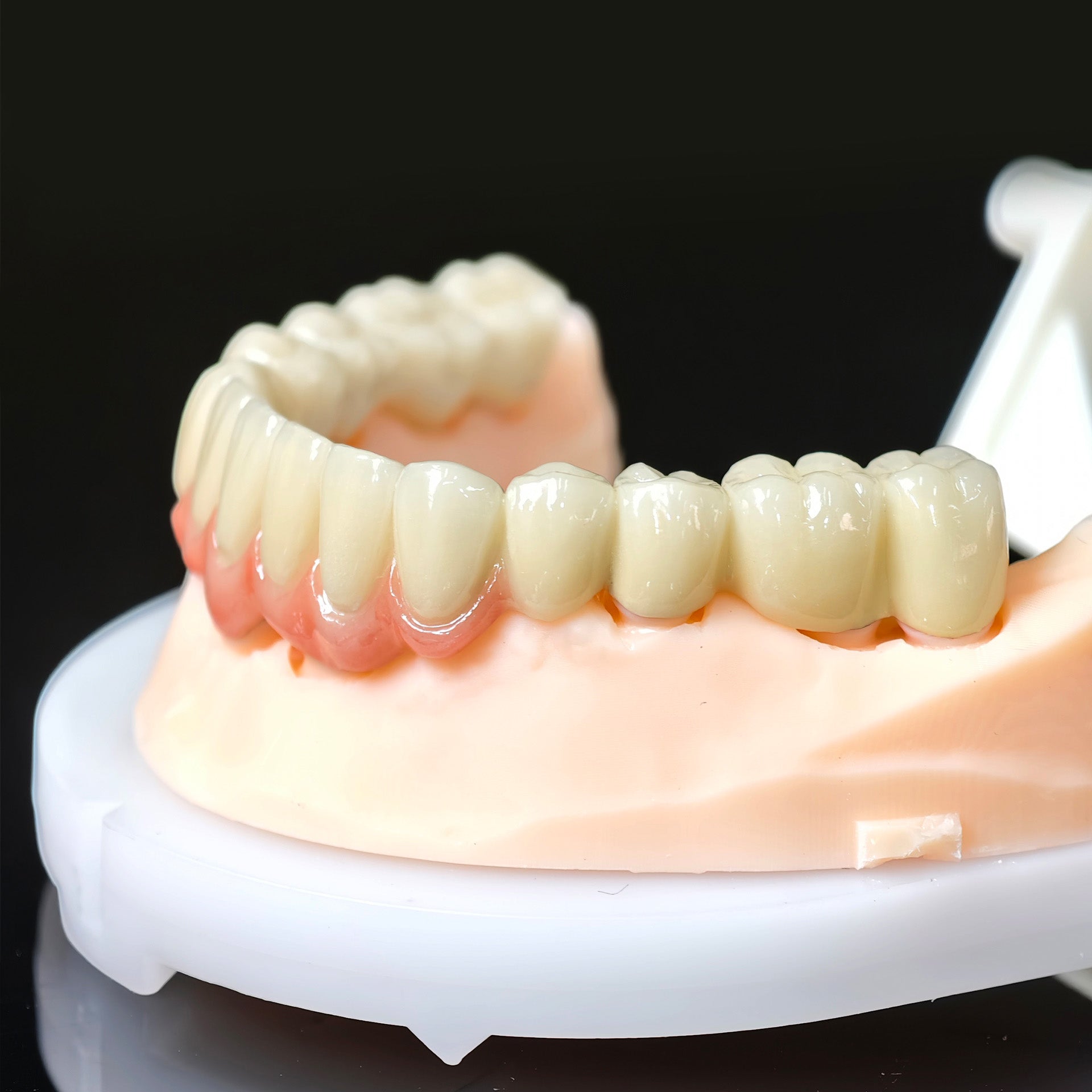 Co - Cr PFM Dental Bridge
