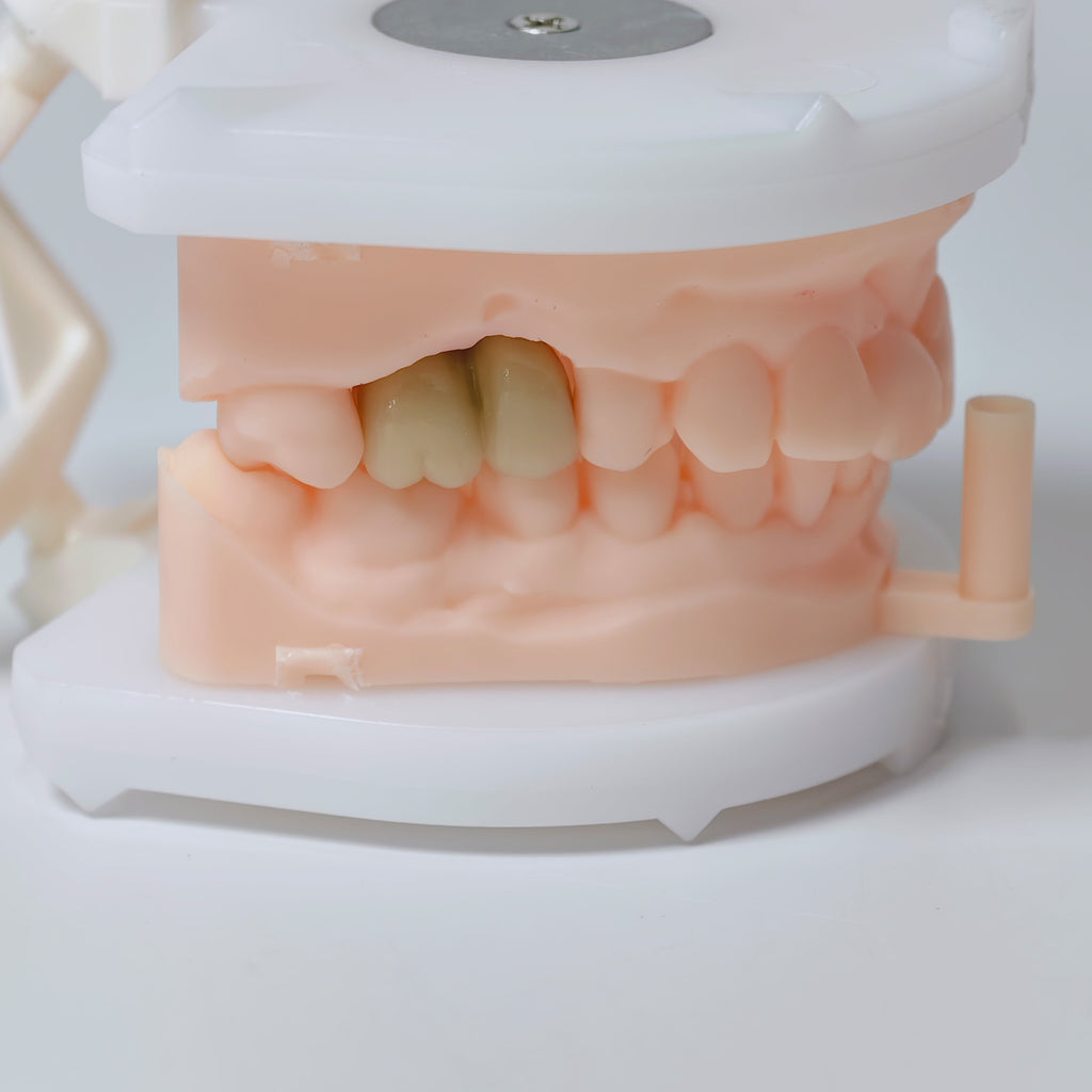 Co - Cr Pfm Dental Crowns And Bridge