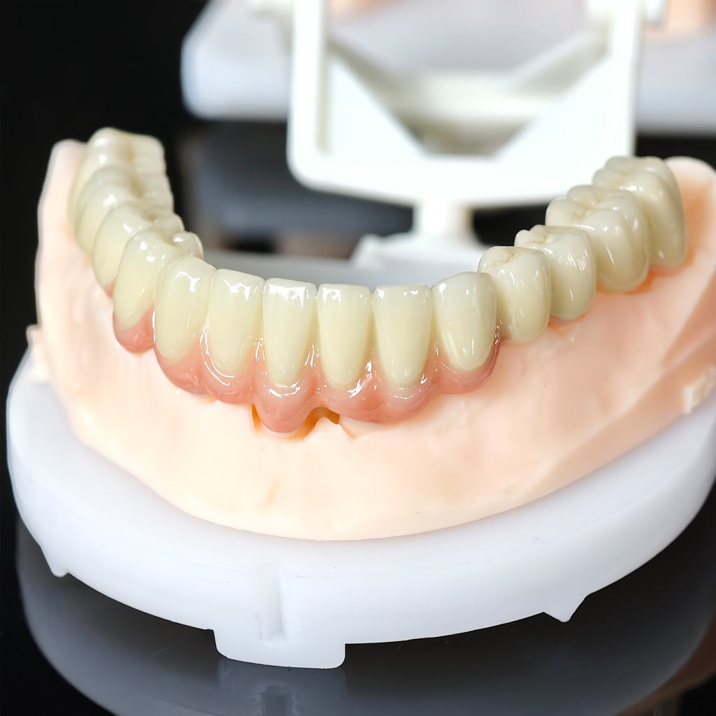 Co - Cr PFM Dental Bridge