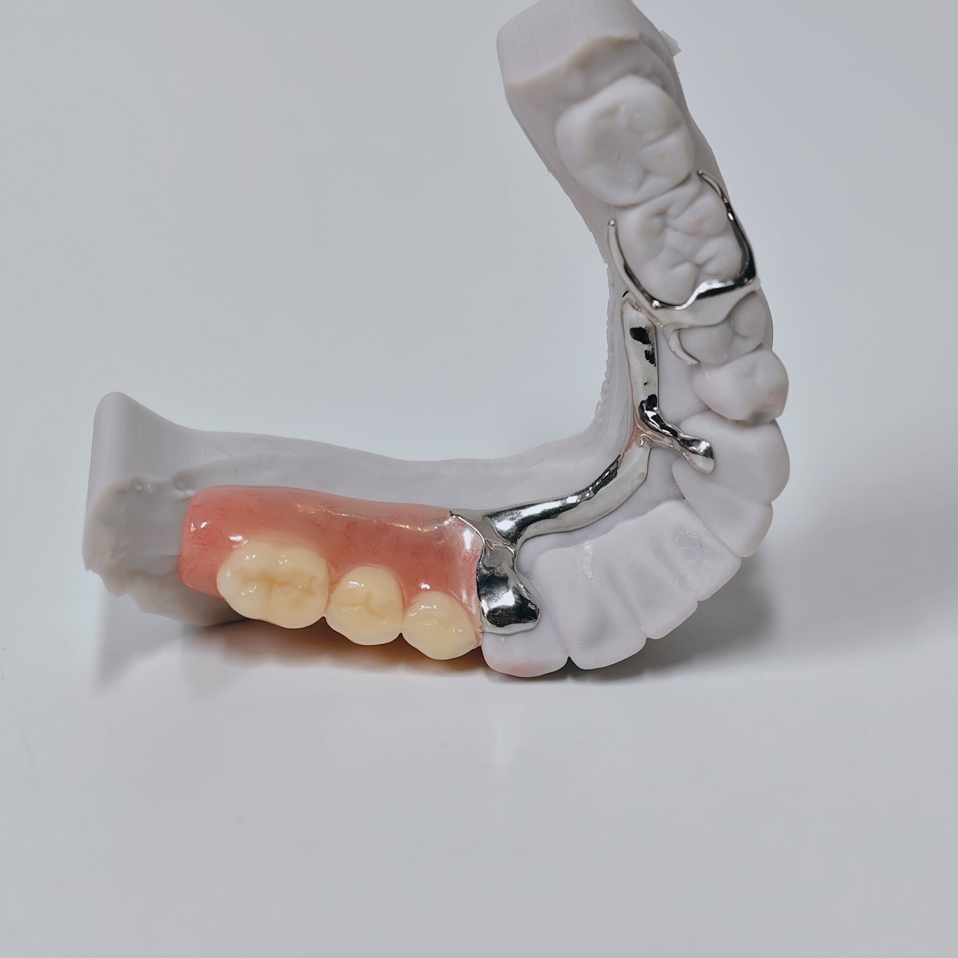 Cobalt Chrome Framework Denture Metal Framework With Acrylic Denture