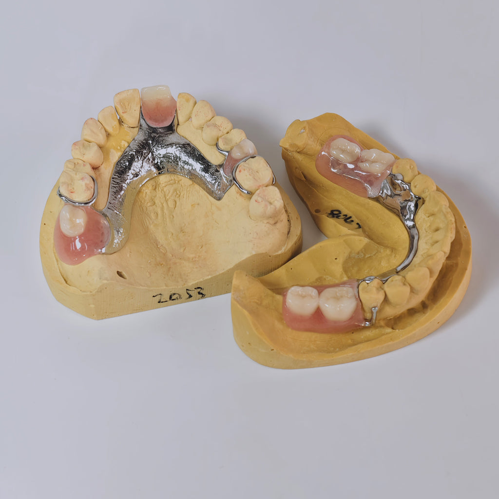 Cobalt Chrome Framework Denture Metal Framework With Acrylic Denture