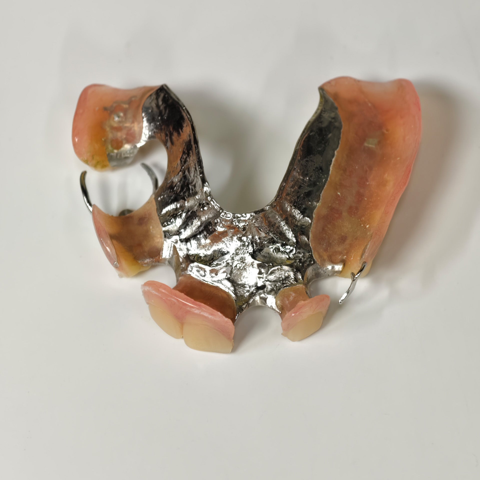 Cobalt Chrome Framework Denture Metal Framework With Acrylic Denture