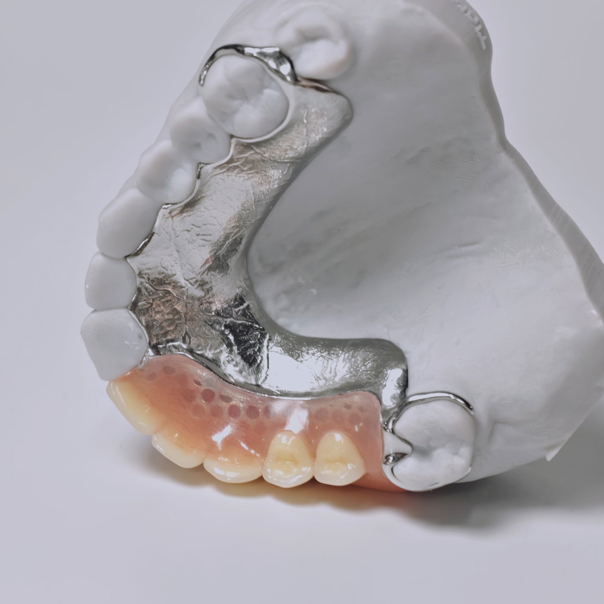 Cobalt Chrome Framework Denture Metal Framework With Acrylic Denture