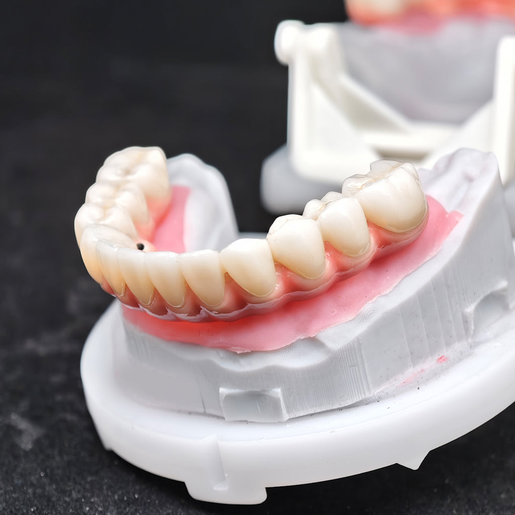 Enhanced Zirconia Crown Malo Bridge