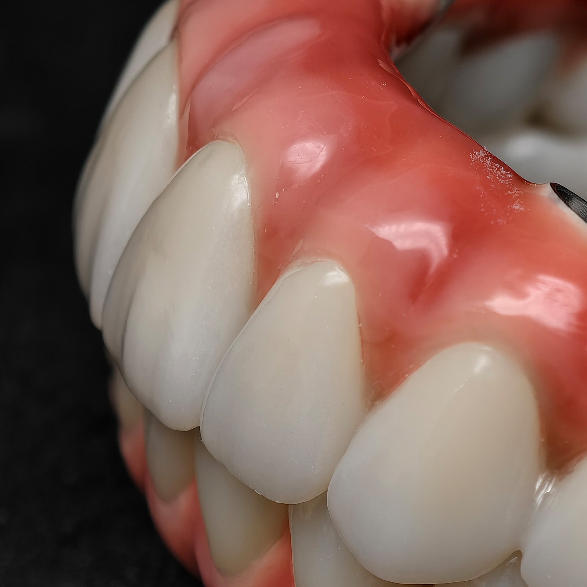 Enhanced Zirconia Crown Malo Bridge