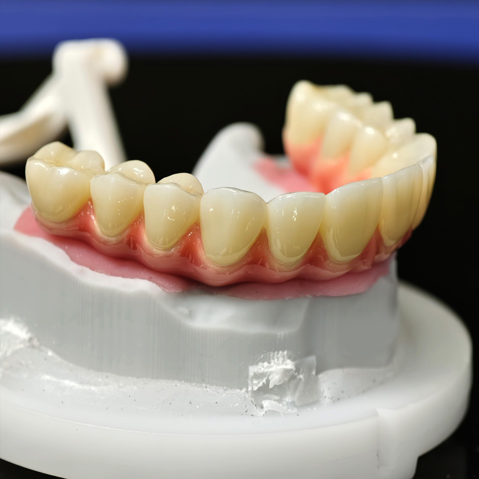 Enhanced Zirconia Crown Malo Bridge