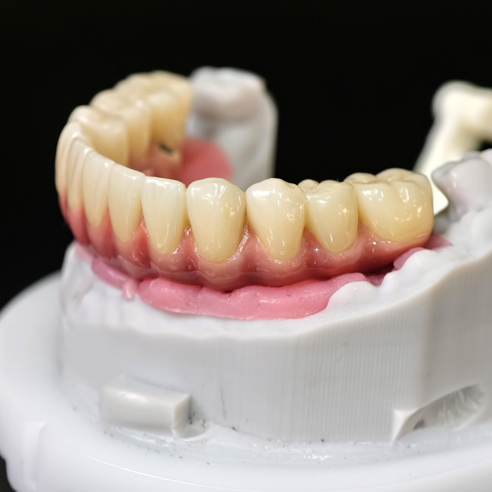 Enhanced Zirconia Crown Malo Bridge