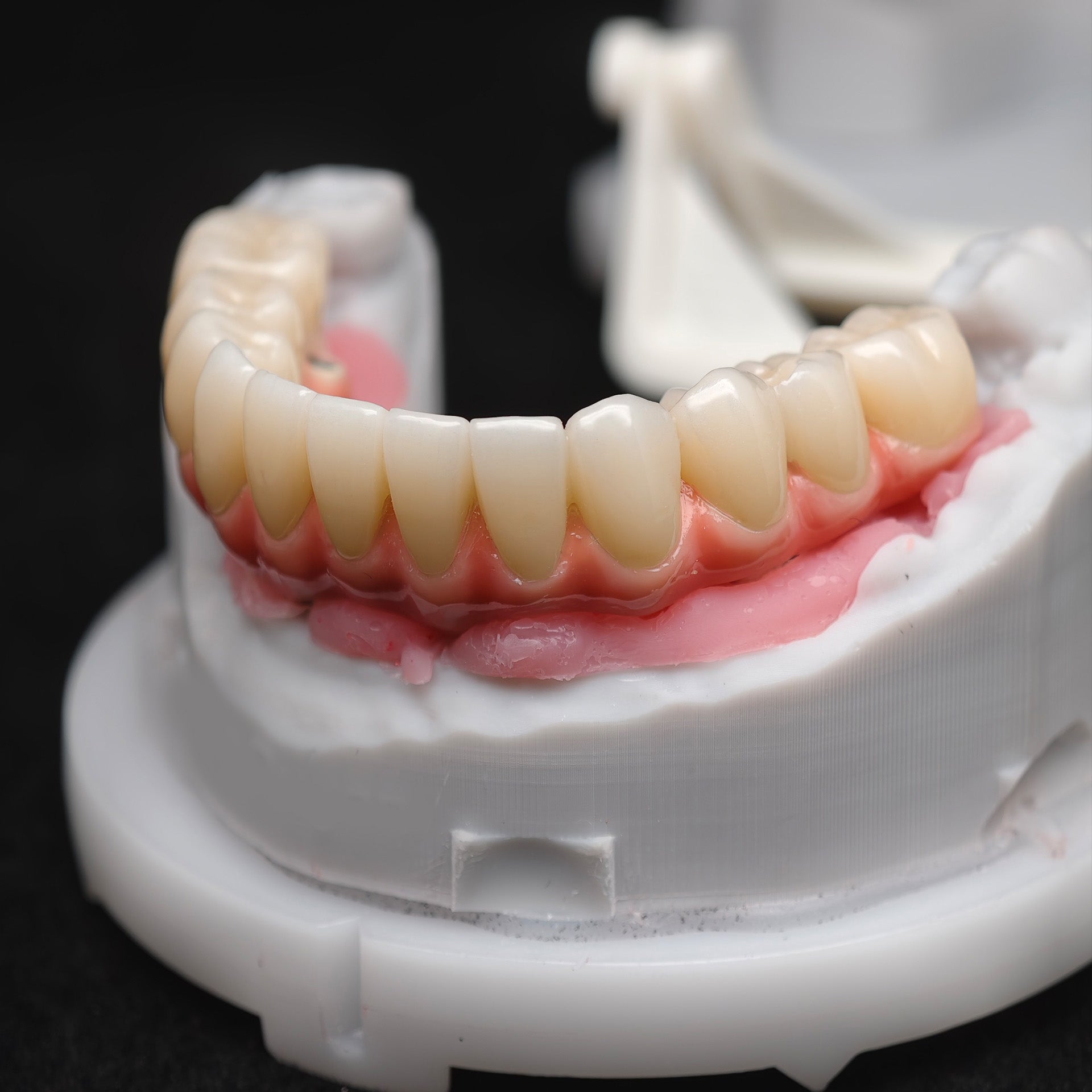 Enhanced Zirconia Crown Malo Bridge