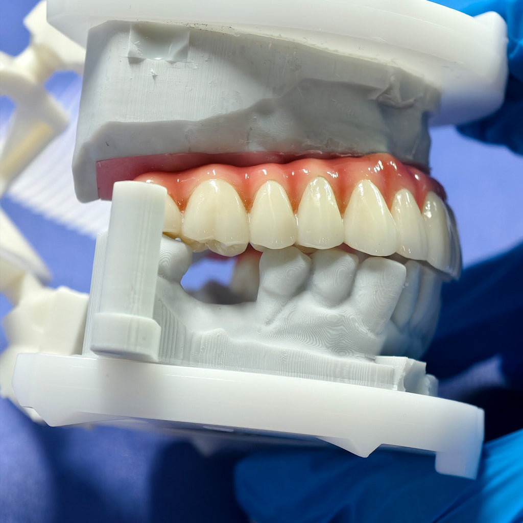 Enhanced Zirconia Crown Malo Bridge