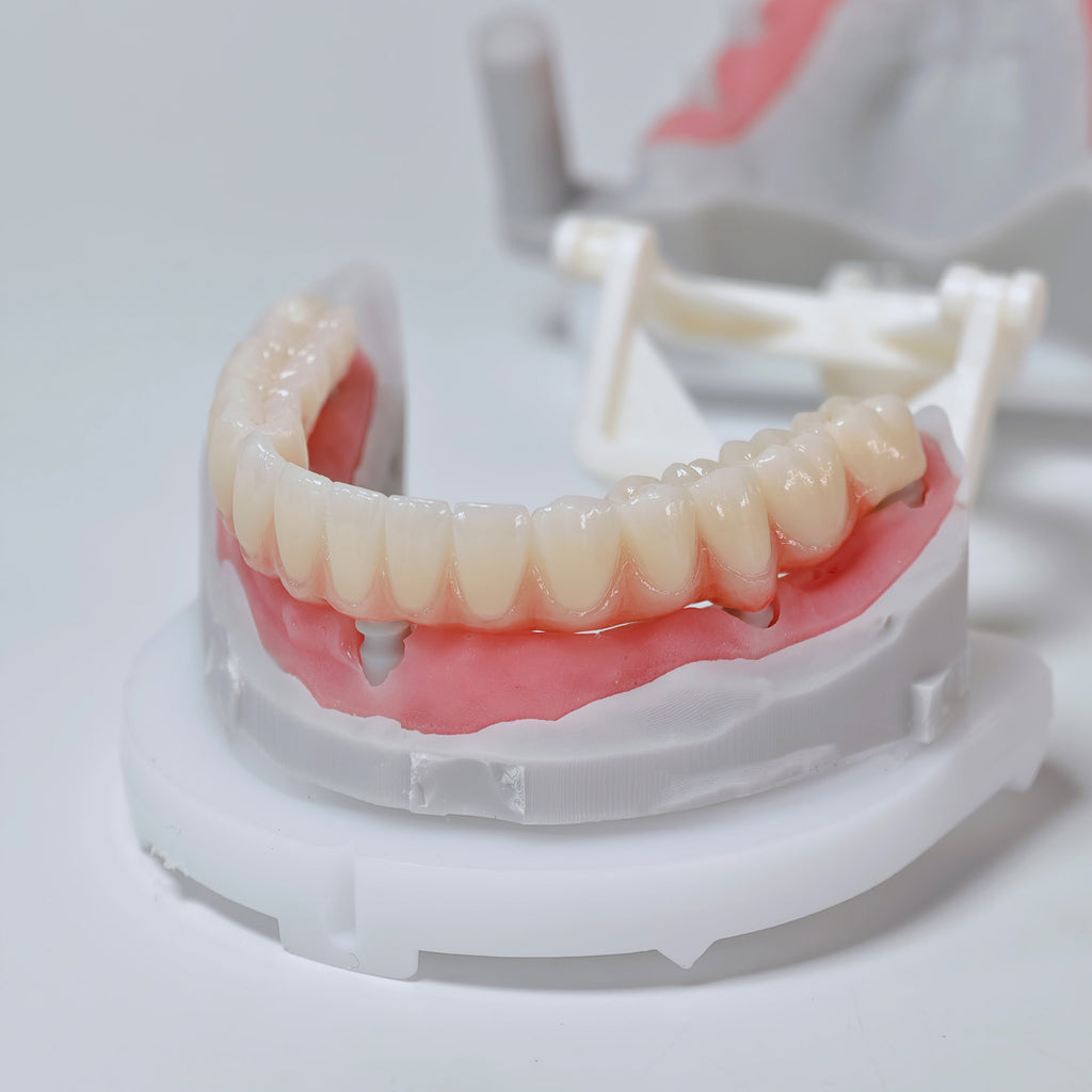 Full-Arch Zirconia Bridge And PMMA Bridge With Cement Retained