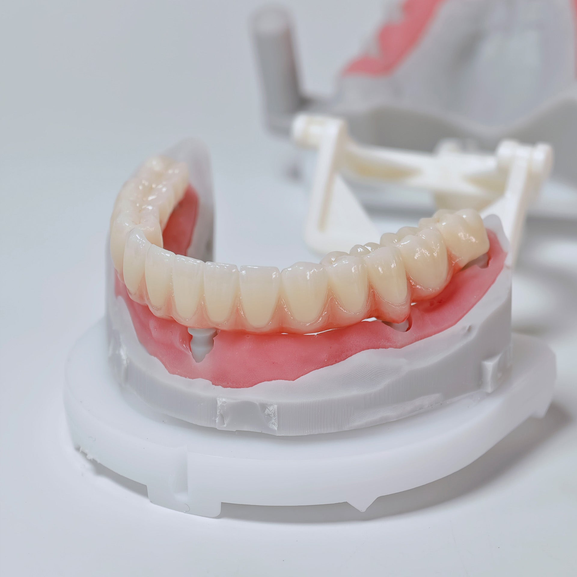 Full-Arch Zirconia Bridge And PMMA Bridge With Cement Retained