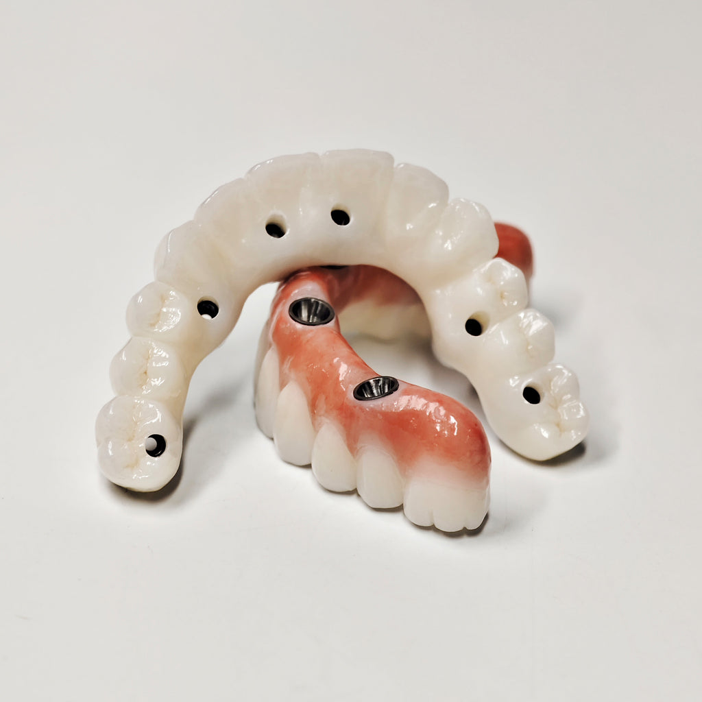 Full-Arch Zirconia Bridge With Ti-Base Abutment