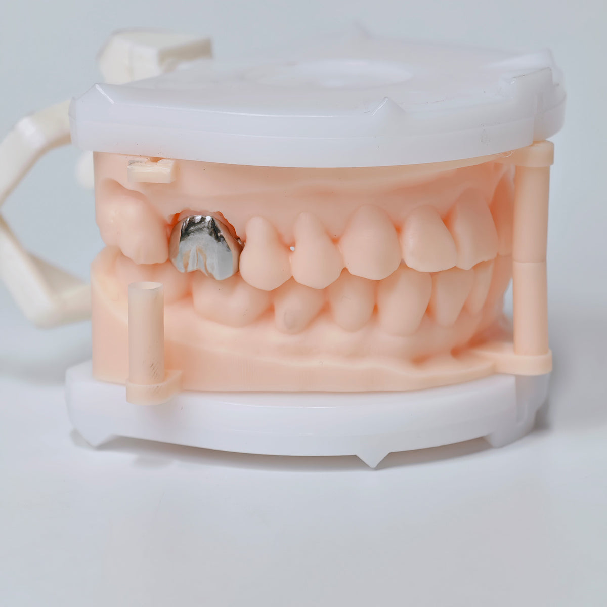 Full Metal Crown Cocr Metal Dental Lab In China