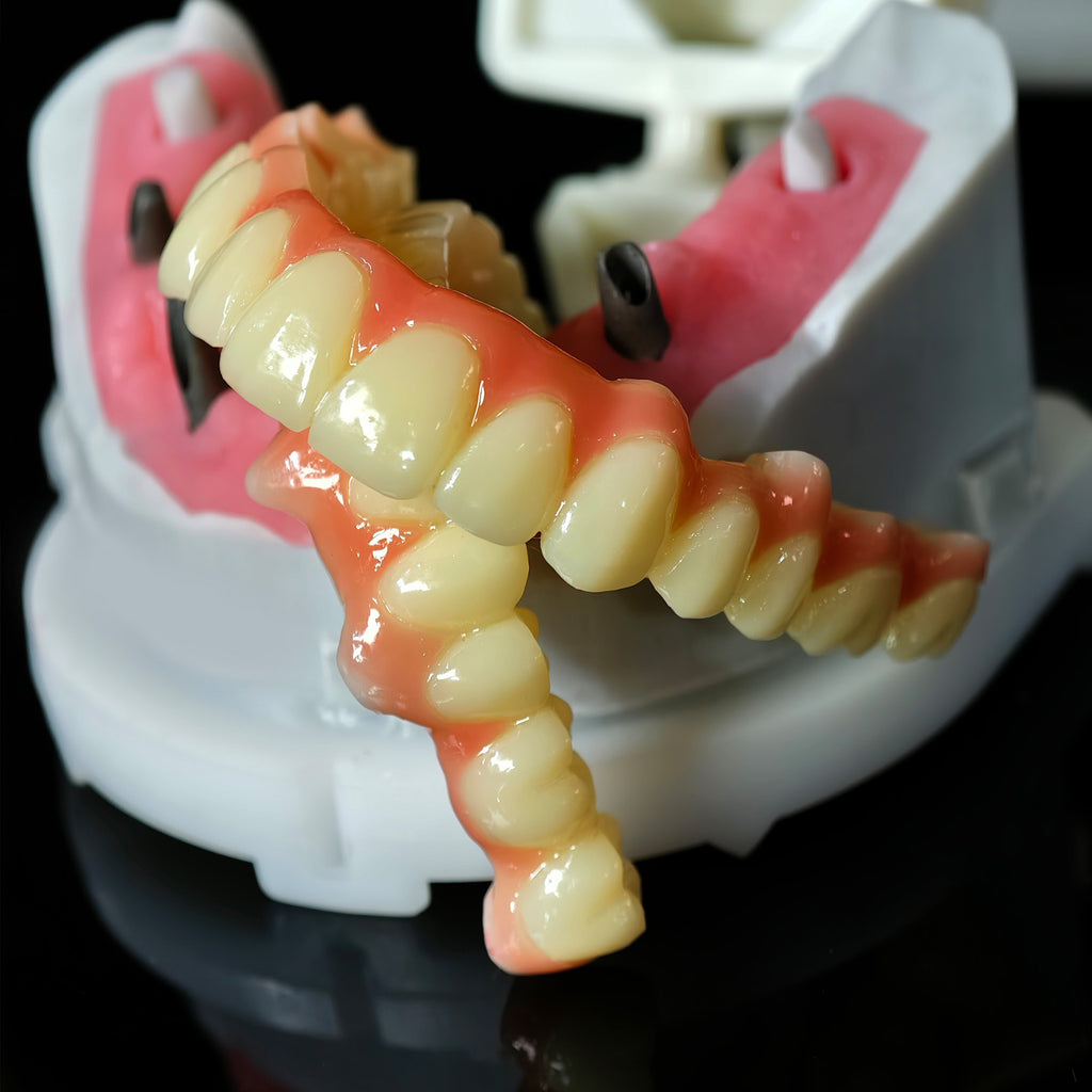 Full=Arch Pmma Bridge With Cement Retained