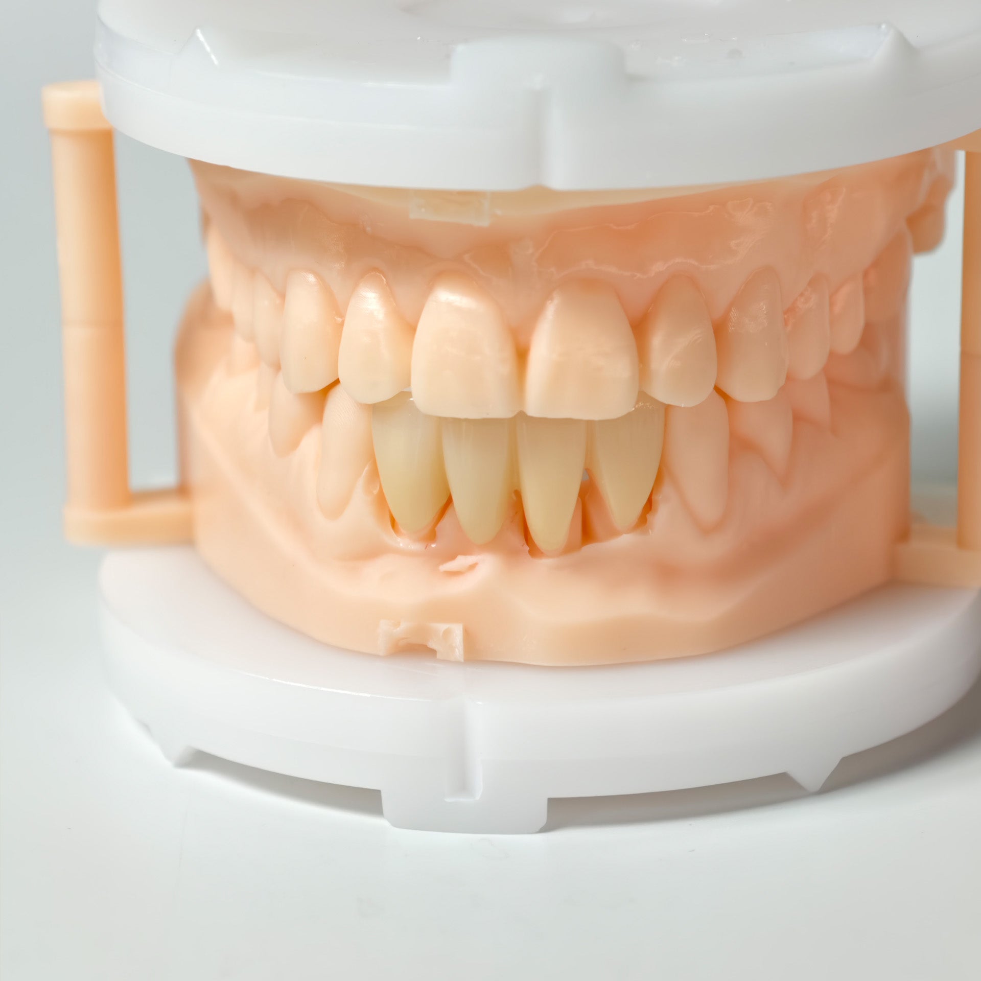 High - Strength Zirconia Bridge