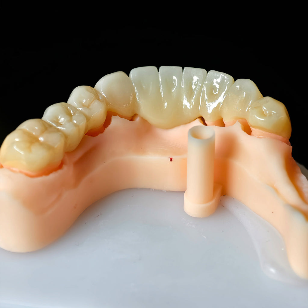 High - Strength Zirconia Bridge