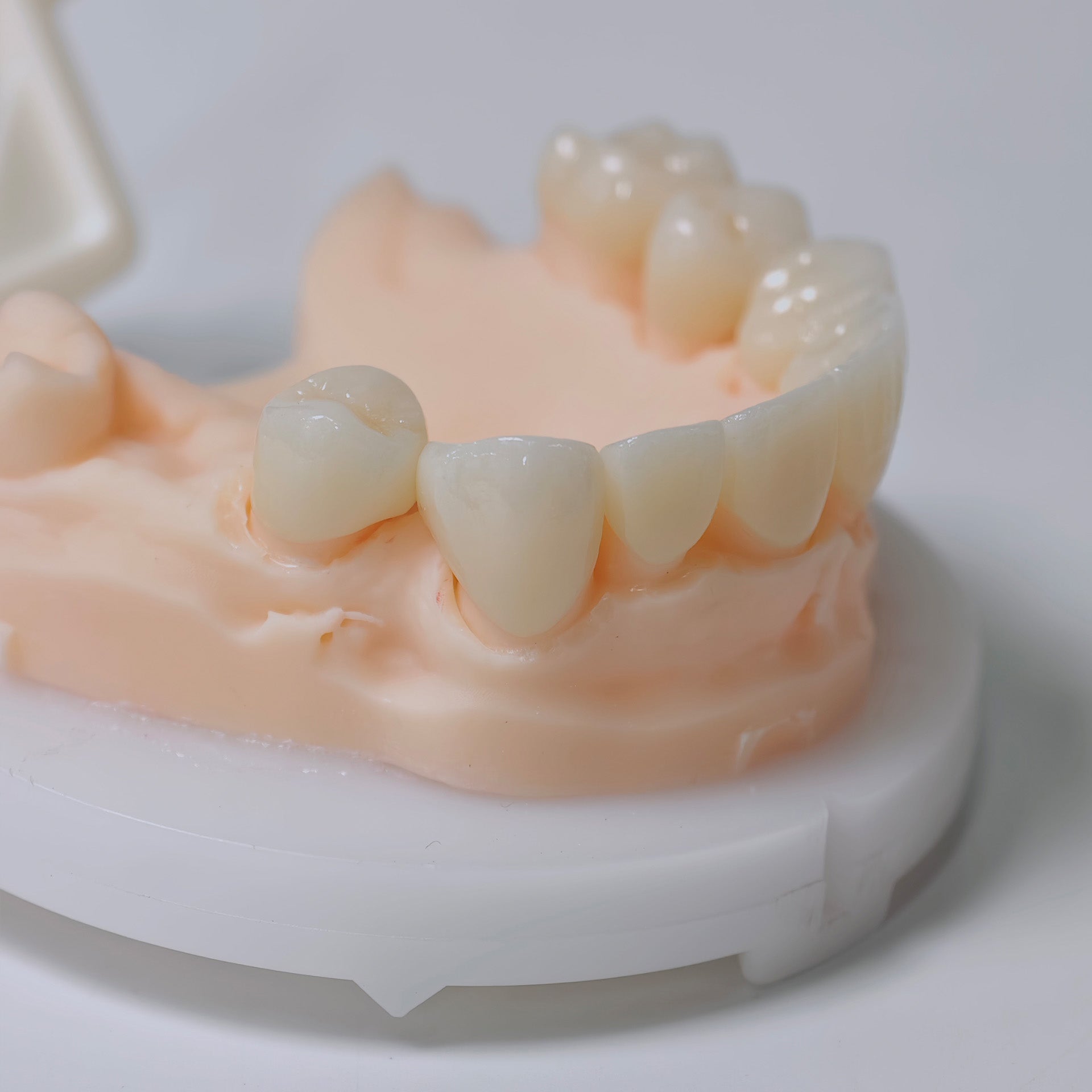 High - Strength Zirconia Bridge And Crown