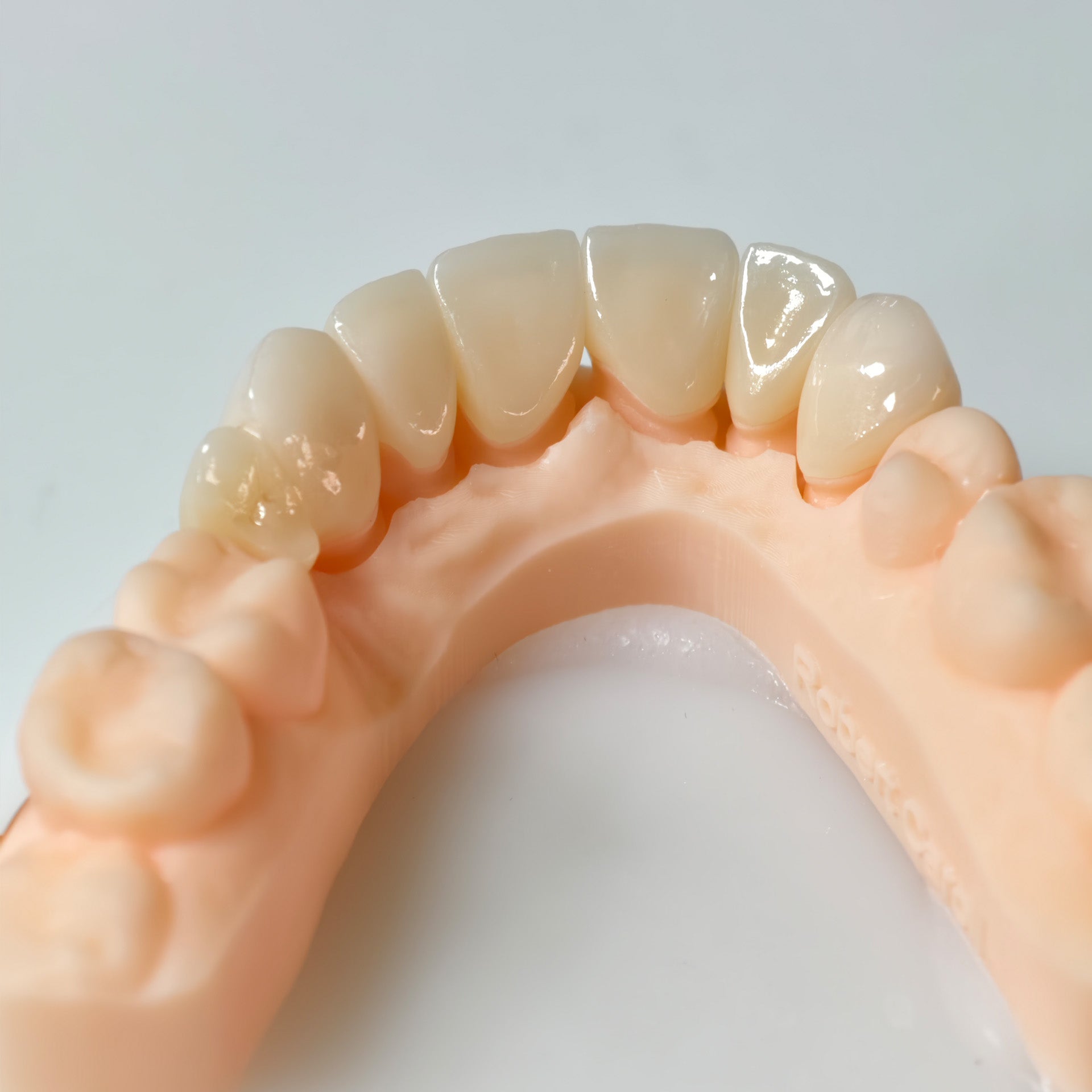 High - Strength Zirconia Crown