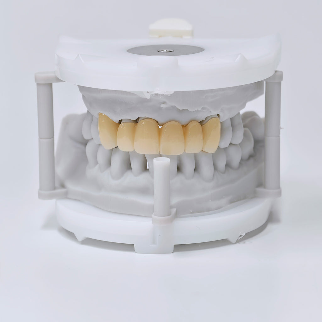 High - Strength Zirconia Crown And Bridge