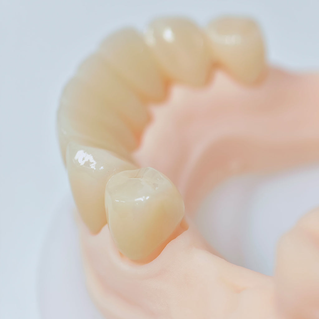 High - Strength Zirconia Crowns