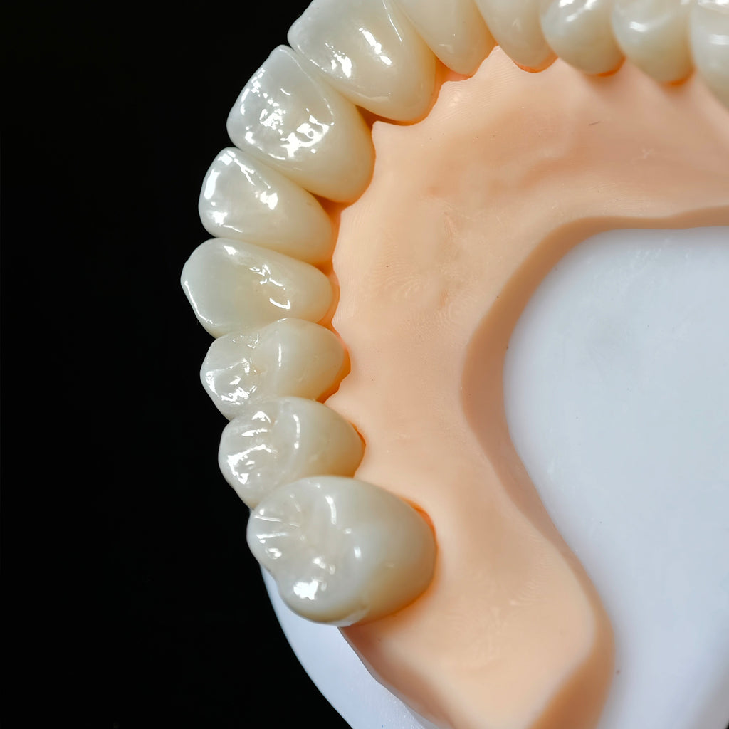 High - Strength Zirconia Crowns
