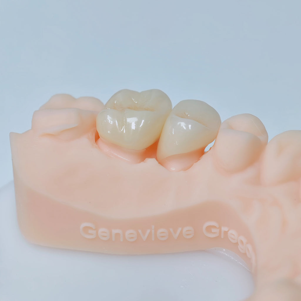 High - Strength Zirconia Crowns