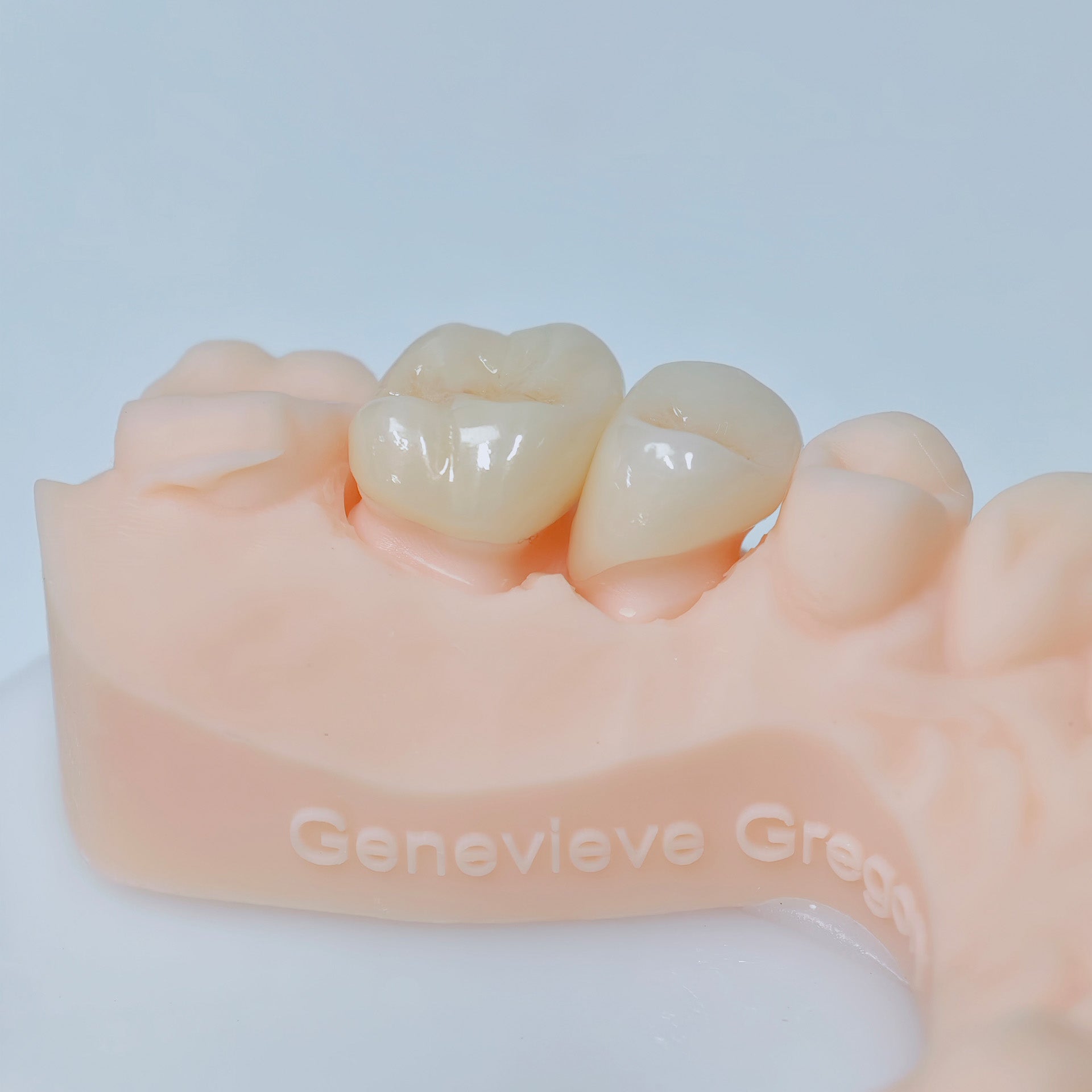 High - Strength Zirconia Crowns
