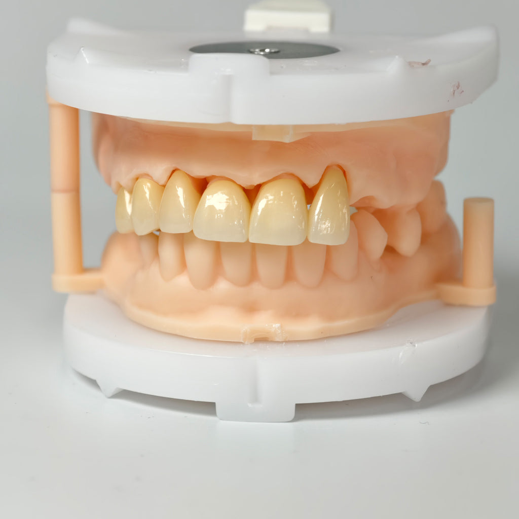 High - Strength Zirconia Crowns