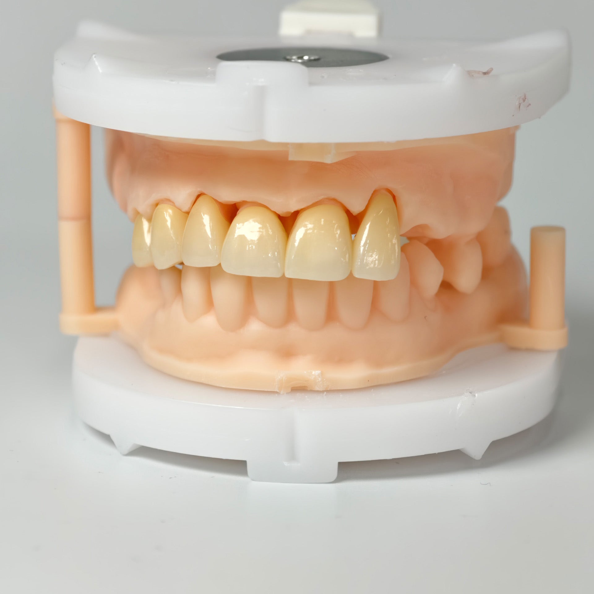 High - Strength Zirconia Crowns