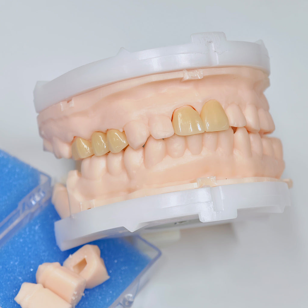 High - Strength Zirconia Crowns