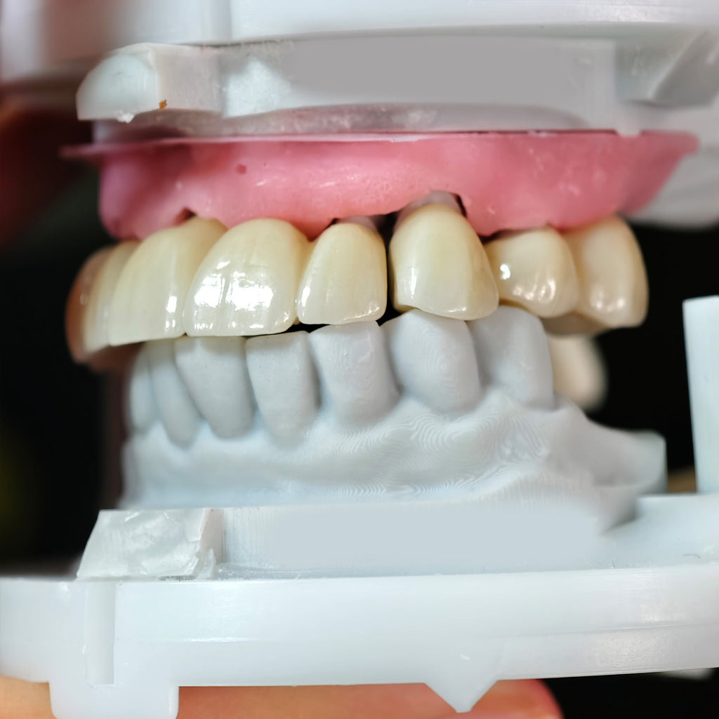High - Strength Zirconia Crowns And Bridge