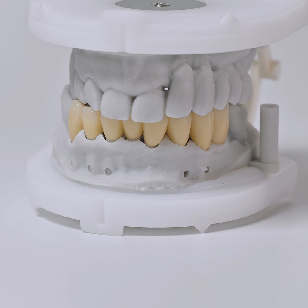 High - Strength Zirconia Crown with Post and core
