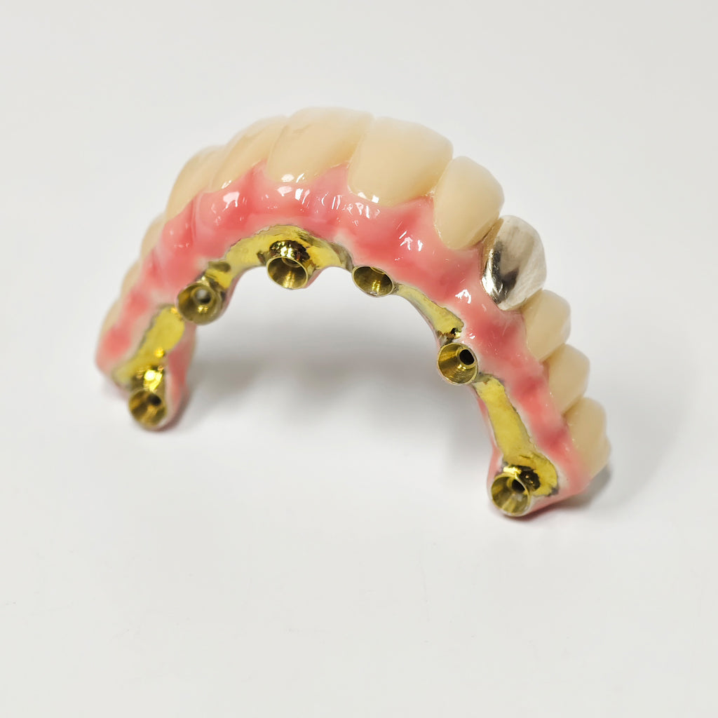 Malo Bridge With Gold-Plated Titanium Framework And A Gold Crown