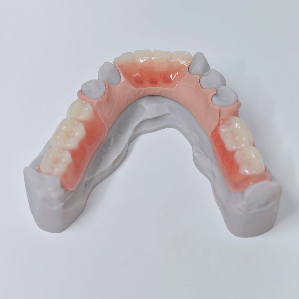 PEEK Framework Denture Metal Framework With Acrylic Denture