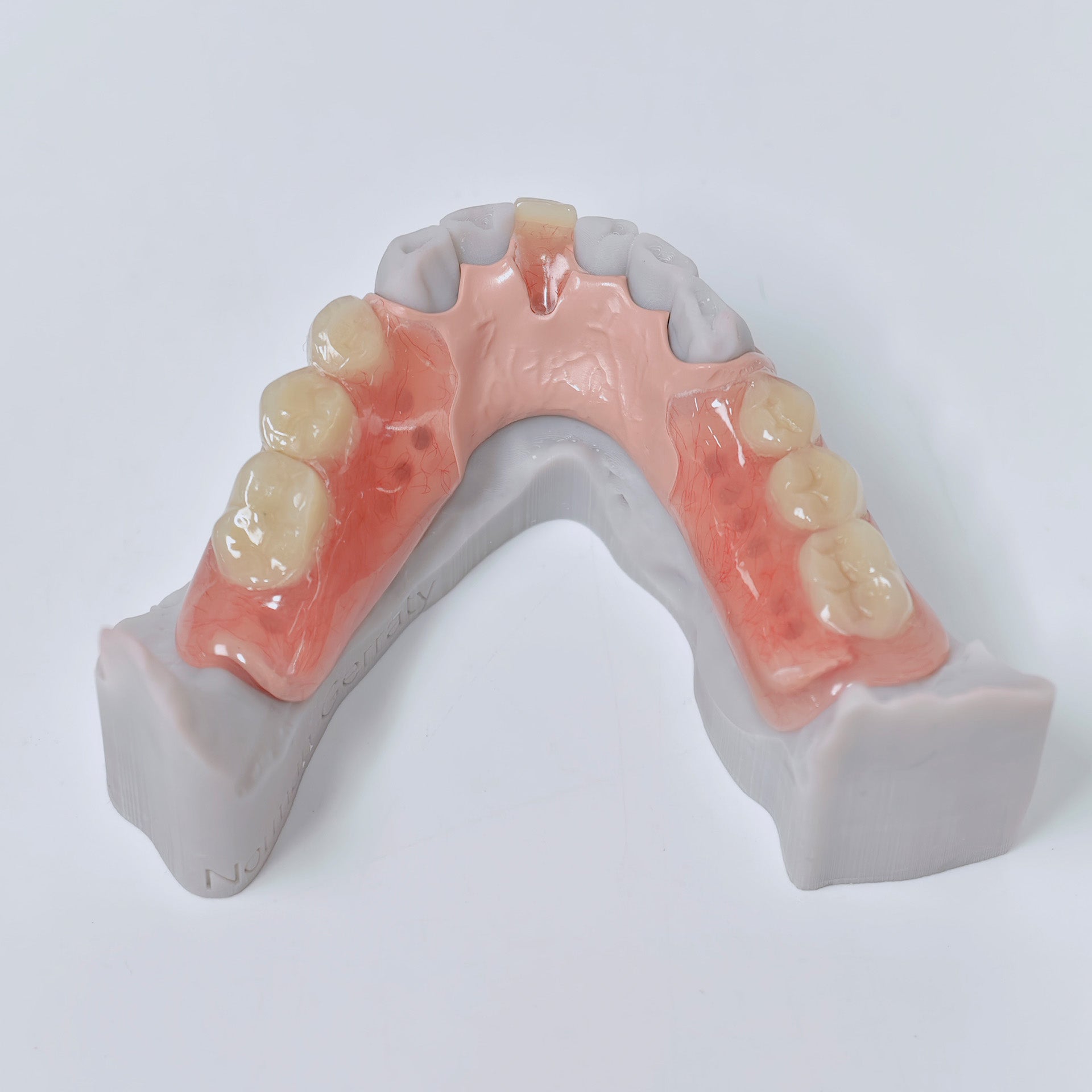 PEEK Framework Denture Metal Framework With Acrylic Denture