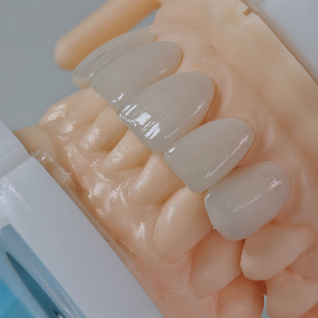 PFZ Porcelain Fused Zirconia Aidite Zirconia