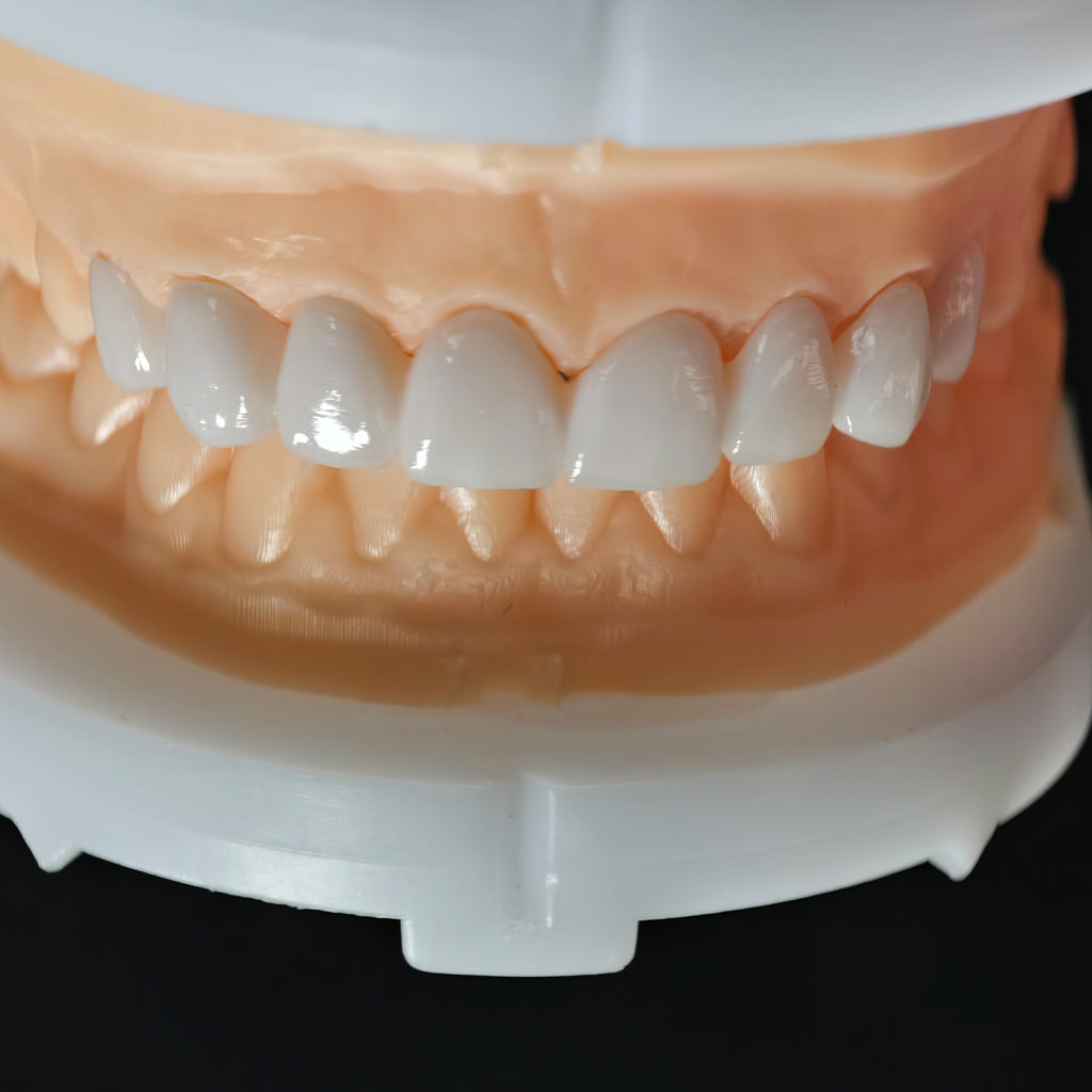 PFZ Porcelain Fused Zirconia Aidite Zirconia