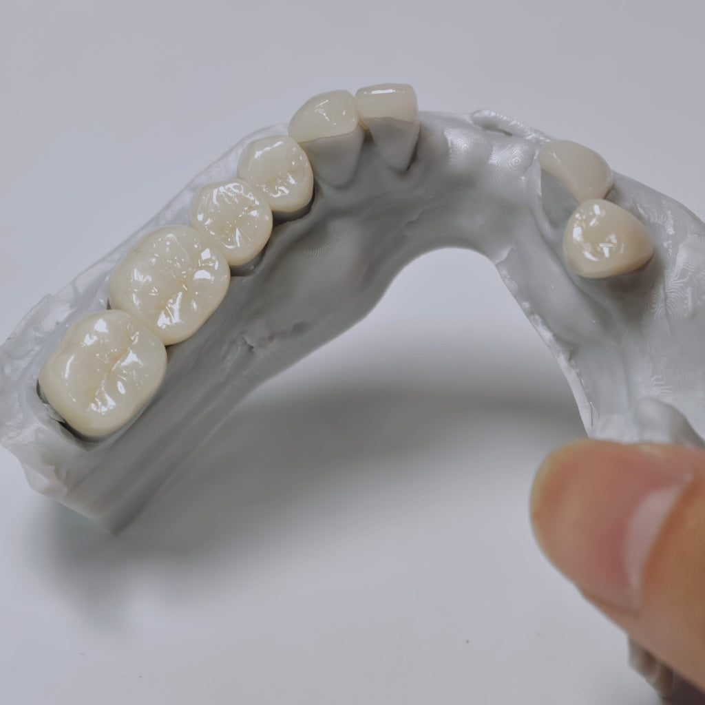 PFZ Porcelain Fused Zirconia Aidite Zirconia