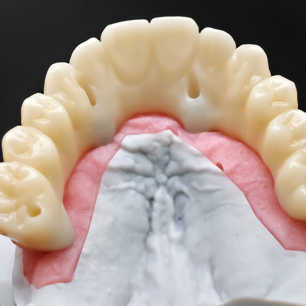 PMMA Bridge With Ti-Base Screw Retained Trying For Full Arch Restoration