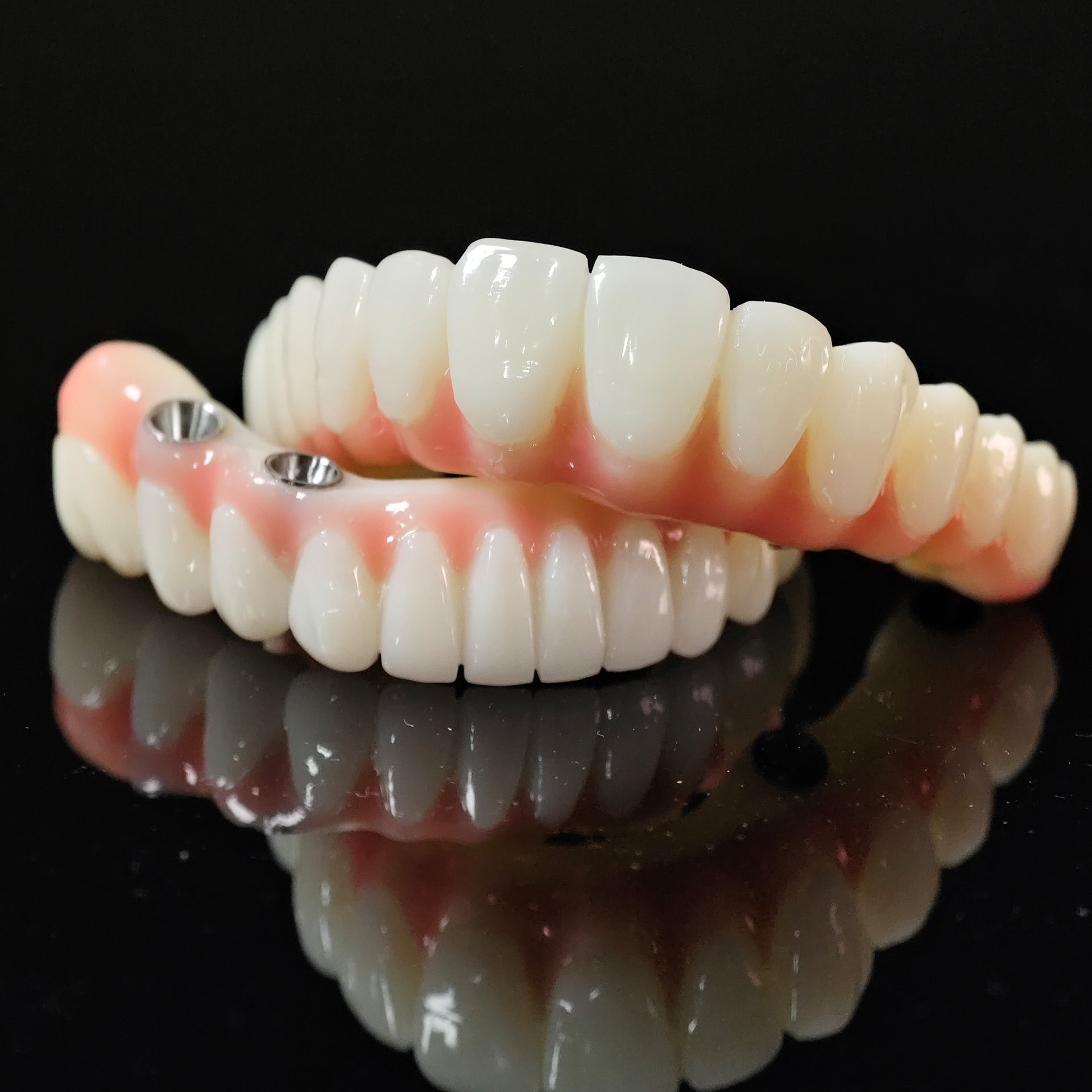 PMMA Bridge With Ti-Base Screw Retained Trying For Full Arch Restoration