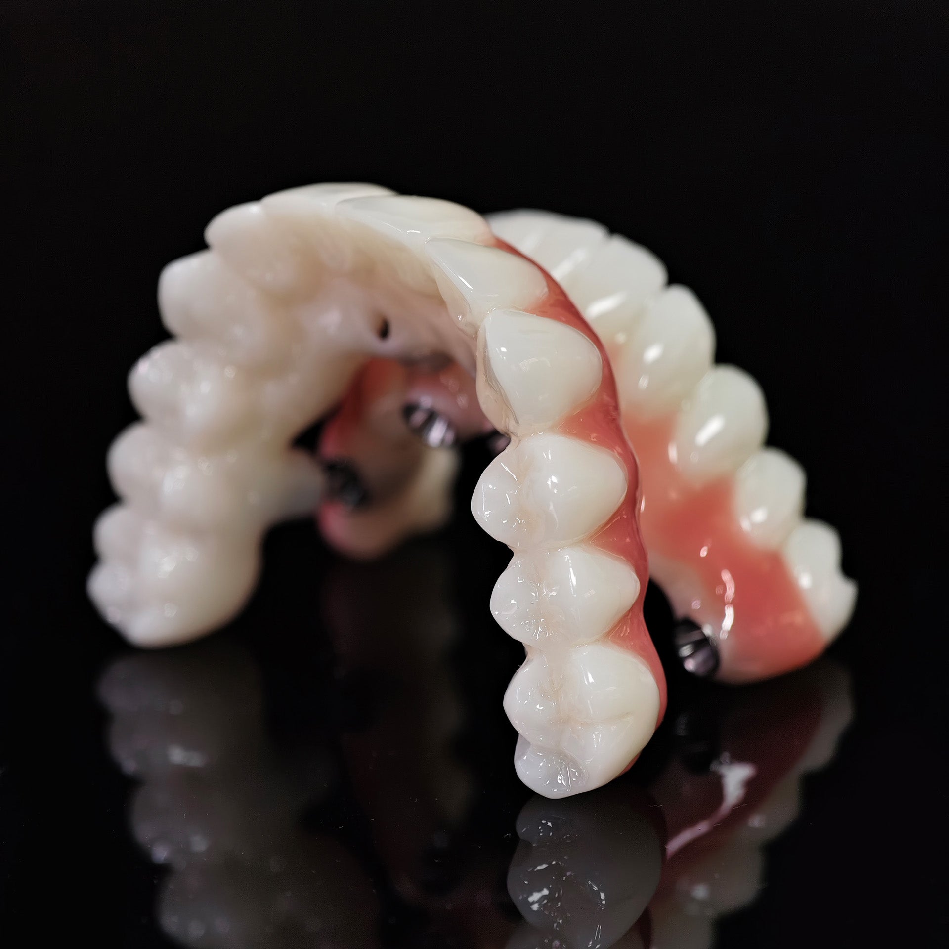 PMMA Bridge With Ti-Base Screw Retained Trying For Full Arch Restoration