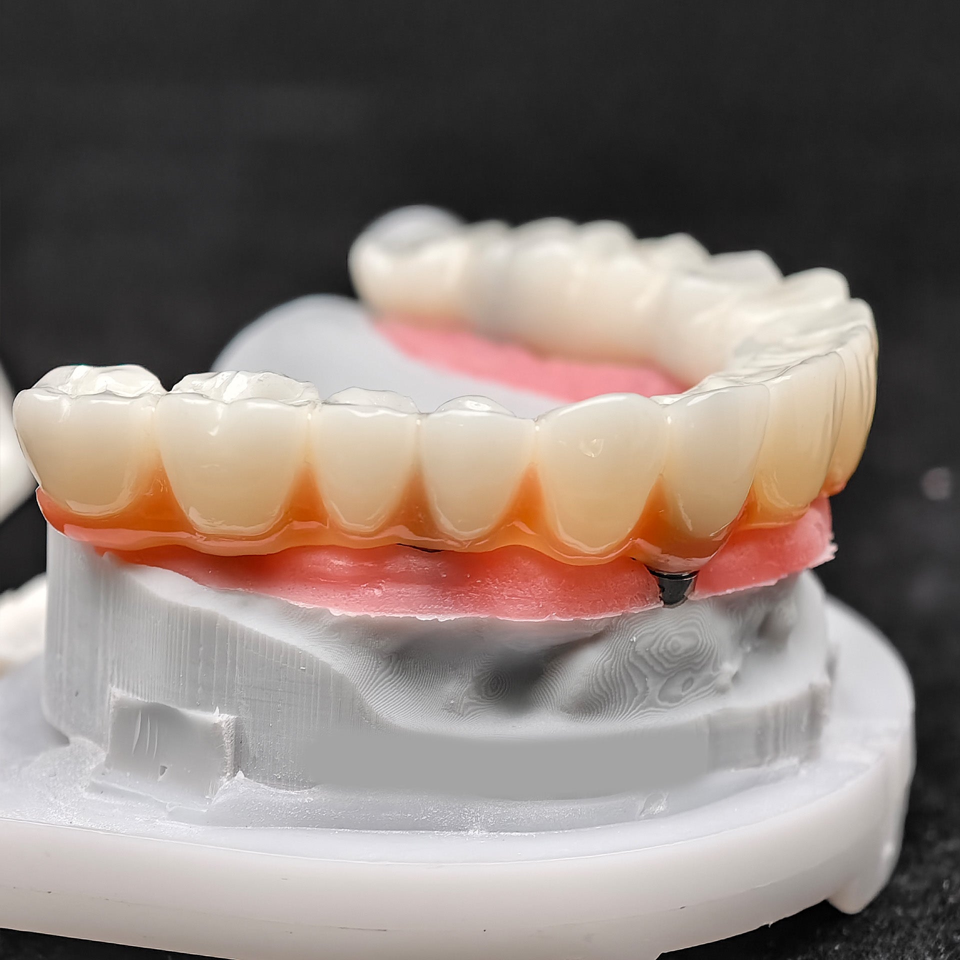 PMMA Bridge With Ti-Base Screw Retained Trying For Full Arch Restoration
