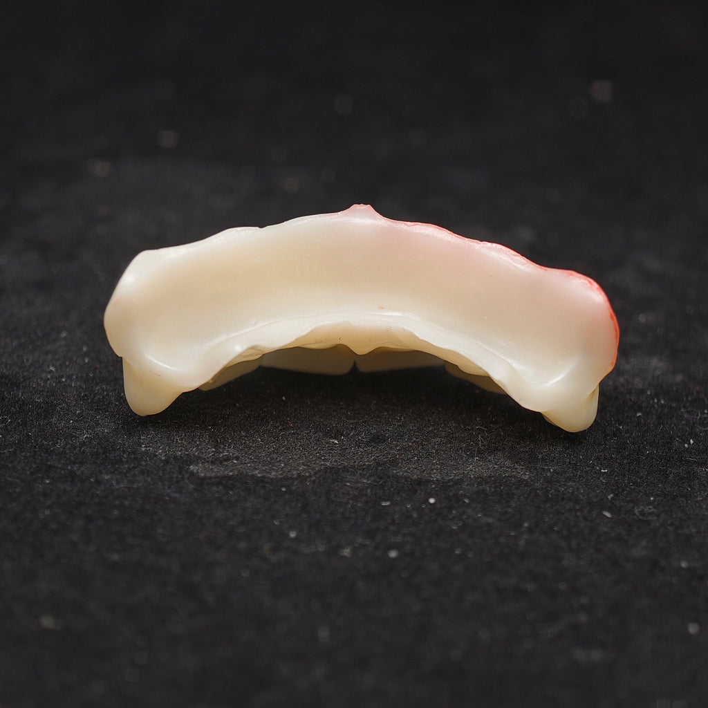 Ti-Bar Pure Titanium Metal Frame With Zirconia Bridge